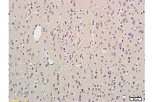 Formalin-fixed and paraffin embedded rat brain labeled with Anti SCN3B Polyclonal Antibody, Unconjugated (ABIN872574) followed by conjugation to the secondary antibody and DAB staining (SCN3B 抗体  (AA 21-120))