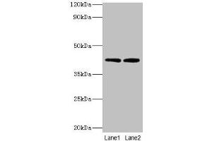 Western blot All lanes: LIAS antibody at 2 μg/mL Lane 1: MCF-7 whole cell lysate Lane 2: K562 whole cell lysate Secondary Goat polyclonal to rabbit IgG at 1/10000 dilution Predicted band size: 42, 37, 38 kDa Observed band size: 42 kDa (LIAS 抗体  (AA 28-372))