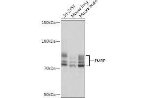 Western blot analysis of extracts of various cell lines, using FMRP Rabbit mAb (ABIN1679778, ABIN3019025, ABIN3019026 and ABIN7101703) at 1:1000 dilution. (FMR1 抗体)