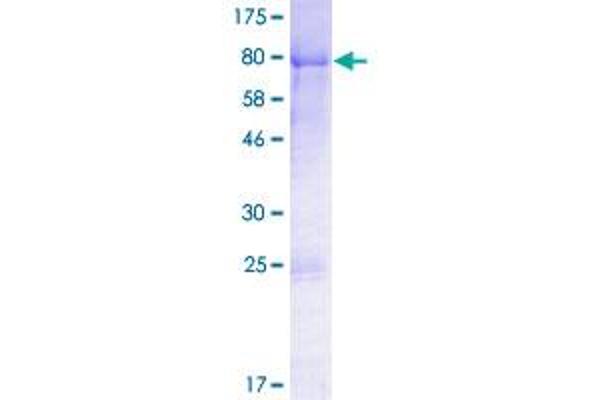 DVL1 Protein (AA 1-444) (GST tag)