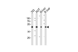 Western Blotting (WB) image for anti-Ornithine Aminotransferase (OAT) (AA 27-55), (N-Term) antibody (ABIN652844)