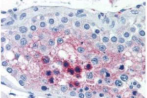 Human Testis (formalin-fixed, paraffin-embedded) stained with CTSL2 antibody ABIN351497 at 10 ug/ml followed by biotinylated anti-mouse IgG secondary antibody ABIN481714, alkaline phosphatase-streptavidin and chromogen. (Cathepsin L2 抗体)