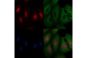 ABIN6257581 and ABIN6273528 staining  cells by IF/ICC.