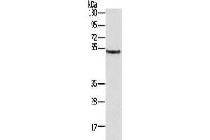 Gel: 8 % SDS-PAGE,Lysate: 40 μg,Primary antibody: ABIN7131472(TRIM14 Antibody) at dilution 1/800 dilution,Secondary antibody: Goat anti rabbit IgG at 1/8000 dilution,Exposure time: 3 seconds (TRIM14 抗体)