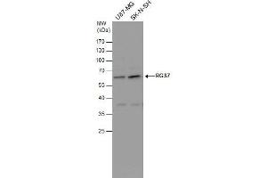 WB Image RGS7 antibody detects RGS7 protein by western blot analysis. (RGS7 抗体)