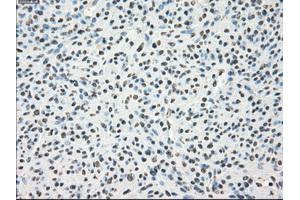 Immunohistochemical staining of paraffin-embedded Kidney tissue using anti-LTA4Hmouse monoclonal antibody. (LTA4H 抗体)