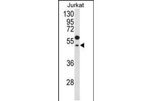 Western blot analysis of GNAT1 Antibody in Jurkat cell line lysates (35ug/lane) (GNAT1 抗体  (C-Term))