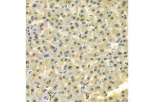 Immunohistochemistry of paraffin-embedded mouse pancreas using DKC1 Antibody (ABIN5970956) at dilution of 1/100 (40x lens). (DKC1 抗体)