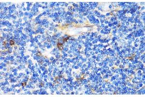 Immunohistochemistry of paraffin-embedded Human tonsil using PTCH1 Polyclonal Antibody at dilution of 1:100 (40x lens). (Patched 1 抗体)