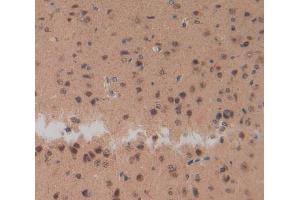 Used in DAB staining on fromalin fixed paraffin-embedded Brain tissue (NPS 抗体  (AA 26-89))
