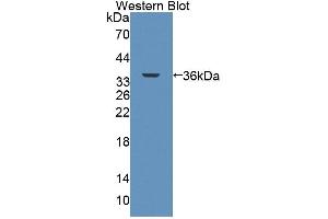 Western Blotting (WB) image for anti-ATP-Binding Cassette, Sub-Family B (MDR/TAP), Member 7 (ABCB7) (AA 472-752) antibody (ABIN5013186)