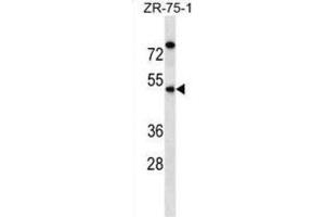 Western Blotting (WB) image for anti-Essential Meiotic Endonuclease 1 Homolog 2 (EME2) antibody (ABIN2998688) (EME2 抗体)