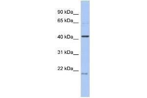 WB Suggested Anti-FAM98B Antibody Titration: 0.