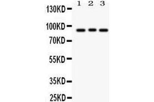 Western Blotting (WB) image for anti-Sema Domain, Immunoglobulin Domain (Ig), Short Basic Domain, Secreted, (Semaphorin) 3A (SEMA3A) (AA 550-771) antibody (ABIN3043328) (SEMA3A 抗体  (AA 550-771))
