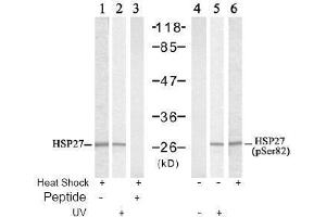 Image no. 2 for anti-Heat Shock 27kDa Protein 1 (HSPB1) (pSer82) antibody (ABIN197004) (HSP27 抗体  (pSer82))