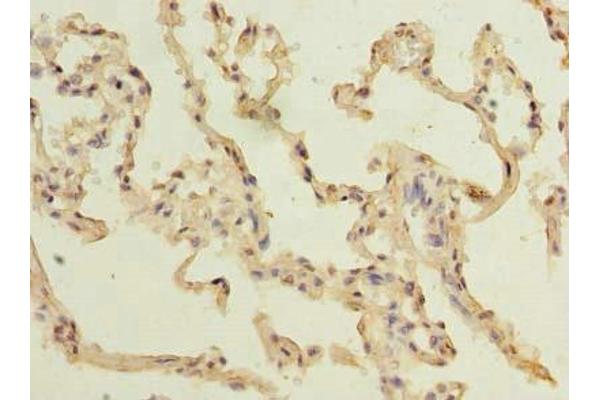 TM4SF1 Antikörper  (AA 115-161)