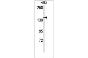 Image no. 1 for anti-Transient Receptor Potential Cation Channel, Subfamily M, Member 7 (TRPM7) (N-Term) antibody (ABIN360498) (TRPM7 抗体  (N-Term))