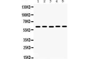 Western Blotting (WB) image for anti-Monoamine Oxidase A (MAOA) (AA 457-493), (C-Term) antibody (ABIN3043872) (Monoamine Oxidase A 抗体  (C-Term))