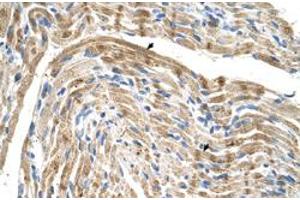 Immunohistochemical staining (Formalin-fixed paraffin-embedded sections) of human muscle with FADS1 polyclonal antibody  at 4-8 ug/mL working concentration. (FADS1 抗体  (C-Term))
