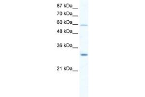 Western Blotting (WB) image for anti-DEAD (Asp-Glu-Ala-Asp) Box Polypeptide 31 (DDX31) antibody (ABIN2461359) (DDX31 抗体)