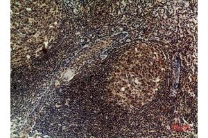 Immunohistochemistry (IHC) analysis of paraffin-embedded Human Tonsilla, antibody was diluted at 1:100.