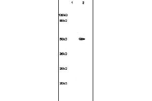 Formalin-fixed and paraffin embedded rat brain labeled with Anti-TUBB3 Polyclonal Antibody, Unconjugated (ABIN706736) at 1:200 followed by conjugation to the secondary antibody and DAB staining (TUBB3 抗体  (AA 401-450))