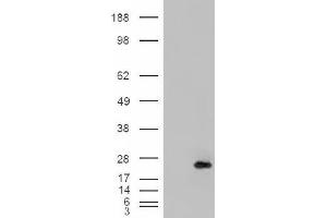 Image no. 1 for anti-Cysteine and Glycine-Rich Protein 2 (CSRP2) (Internal Region) antibody (ABIN374898) (CSRP2 抗体  (Internal Region))