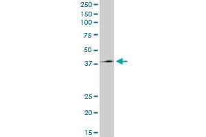 Western Blotting (WB) image for anti-HNF1 Homeobox B (HNF1B) (AA 29-118) antibody (ABIN520767)