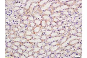Immunohistochemistry (IHC) image for anti-Prostaglandin E Receptor 1 (Subtype EP1), 42kDa (PTGER1) (AA 61-160) antibody (ABIN872820)