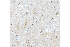 IHC analysis of PKC Epsilon/PRKCE using anti-PKC Epsilon/PRKCE antibody (ABIN3043908).