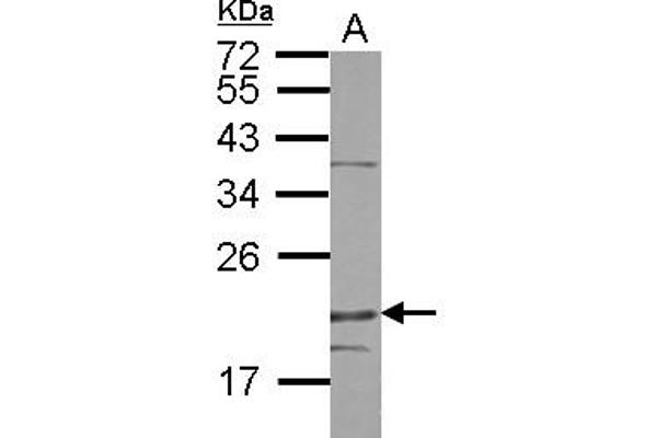 Density Regulated Protein 抗体  (AA 1-198)