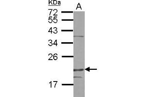 Western Blotting (WB) image for anti-Density-Regulated Protein (DENR) (AA 1-198) antibody (ABIN1501885) (Density Regulated Protein 抗体  (AA 1-198))