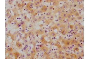 IHC image of ABIN7127534 diluted at 1:215 and staining in paraffin-embedded human liver tissue performed on a Leica BondTM system. (Recombinant Hepcidin 抗体)