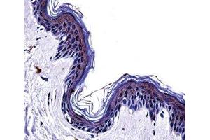 Tyrosinase antibody immunohistochemistry analysis in formalin fixed and paraffin embedded human skin tissue. (TYR 抗体  (AA 486-513))