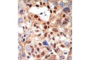 Image no. 2 for anti-Promyelocytic Leukemia (PML) (Sumoylation Site) antibody (ABIN357734) (PML 抗体  (Sumoylation Site))