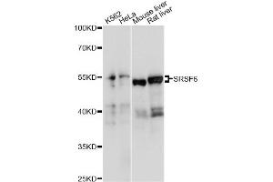 Western blot analysis of extracts of various cell lines, using SRSF6 antibody (ABIN6293560) at 1:1000 dilution. (SFRS6 抗体)