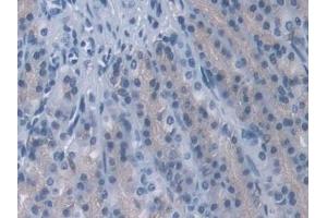 Immunohistochemistry (IHC) image for anti-Protein Phosphatase 2A Activator, Regulatory Subunit 4 (PPP2R4) (AA 1-323) antibody (ABIN7441121)
