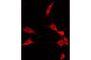 ABIN6274810 staining 293 by IF/ICC. (ADAM32 抗体  (C-Term))
