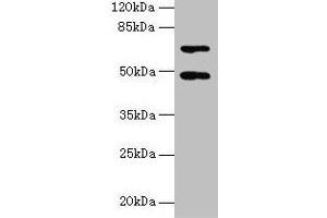 Western blot All lanes: HDAC3 antibody at 2 μg/mL + Hela whole cell lysate Secondary Goat polyclonal to rabbit IgG at 1/10000 dilution Predicted band size: 49, 50 kDa Observed band size: 49 kDa (HDAC3 抗体  (AA 1-428))