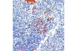 Immunohistochemistry (IHC) image for anti-S100 Calcium Binding Protein A8 (S100A8) (AA 1-93) antibody (ABIN7270129)