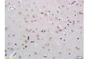 Formalin-fixed and paraffin embedded rat brain tissue labeled with Anti-KDM5B/PLU1/Jarid1B Polyclonal Antibody, Unconjugated  at 1:200 followed by conjugation to the secondary antibody and DAB staining (KDM5B 抗体  (AA 65-165))