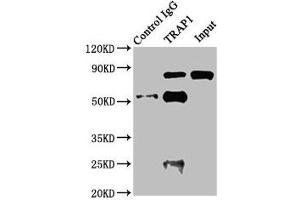 Immunoprecipitating TRAP1 in Jurkat whole cell lysate Lane 1: Rabbit control IgG instead of ABIN7154903 in Jurkat whole cell lysate. (TRAP1 抗体  (AA 60-308))