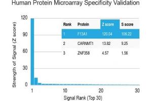 Analysis of HuProt(TM) microarray containing more than 19,000 full-length human proteins using Factor XIIIa antibody (clone F13A1/1448). (F13A1 抗体  (AA 46-181))