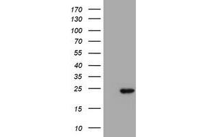 Western Blotting (WB) image for anti-Proteasome (Prosome, Macropain) Subunit, beta Type, 9 (Large Multifunctional Peptidase 2) (PSMB9) (AA 21-219) antibody (ABIN1491192) (PSMB9 抗体  (AA 21-219))
