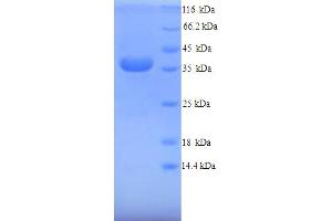 SDS-PAGE (SDS) image for Arginase, Liver (ARG1) (AA 1-323), (full length) protein (His tag) (ABIN5714380) (Liver Arginase Protein (AA 1-323, full length) (His tag))
