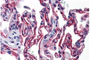 Immunohistochemistry (Formalin-fixed Paraffin-embedded Sections) (IHC (fp)) image for anti-Advanced Glycosylation End Product-Specific Receptor (AGER) (AA 23-405) antibody (ABIN790485)