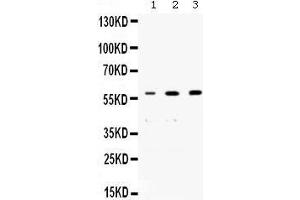 Western blot analysis of nmt55/p54nrb expression in rat brain extract (lane 1), human placenta extract (lane 2) and PANC whole cell lysates (lane 3). (NONO 抗体  (N-Term))