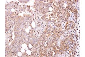 IHC-P Image STOML1 antibody [N2C3] detects STOML1 protein at cytosol on HSC-3 xenograft by immunohistochemical analysis. (STOML1 抗体)