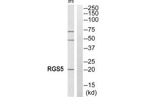Western blot analysis of extracts from NIH/3T3 cells, using RGS5 antibody. (RGS5 抗体  (Internal Region))