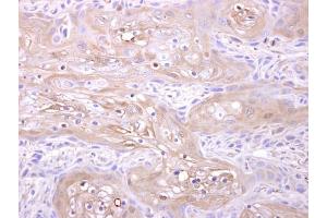 IHC-P Image Adenylate kinase 1 antibody [N1C3] detects Adenylate kinase 1 protein at cytosol on Ca922 xenograft by immunohistochemical analysis. (Adenylate Kinase 1 抗体)
